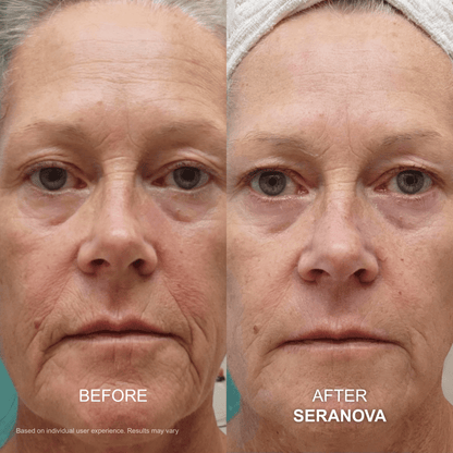 The Micro Infusion System